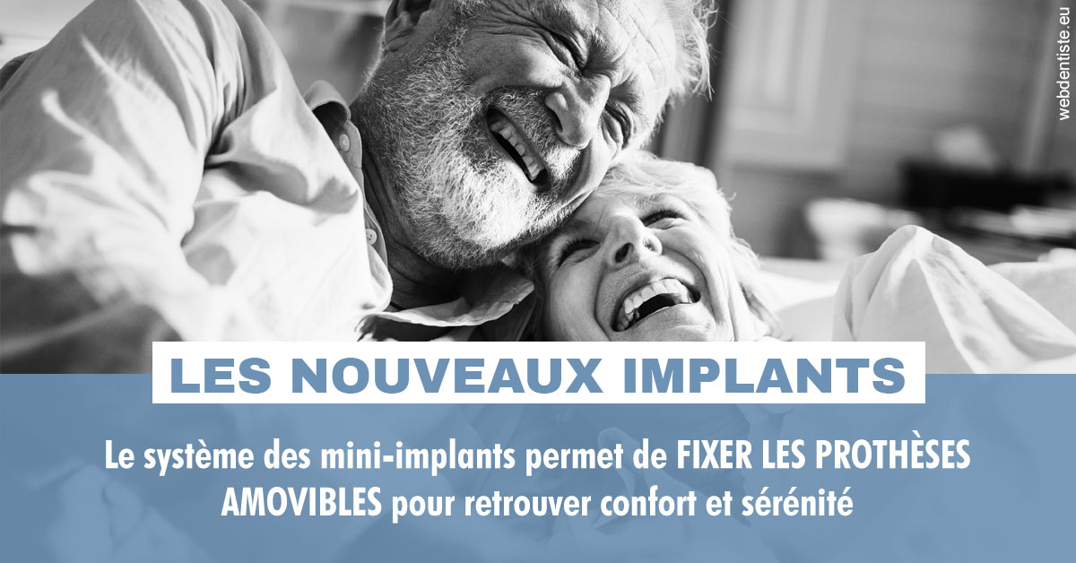 https://dr-jacques-wemaere.chirurgiens-dentistes.fr/Les nouveaux implants 2