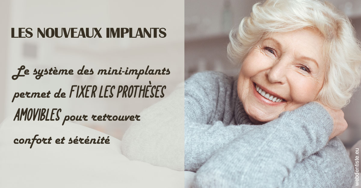 https://dr-jacques-wemaere.chirurgiens-dentistes.fr/Les nouveaux implants 1