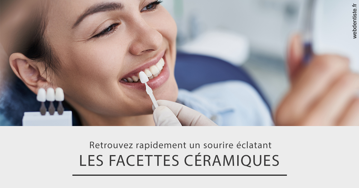 https://dr-jacques-wemaere.chirurgiens-dentistes.fr/Les facettes céramiques 2