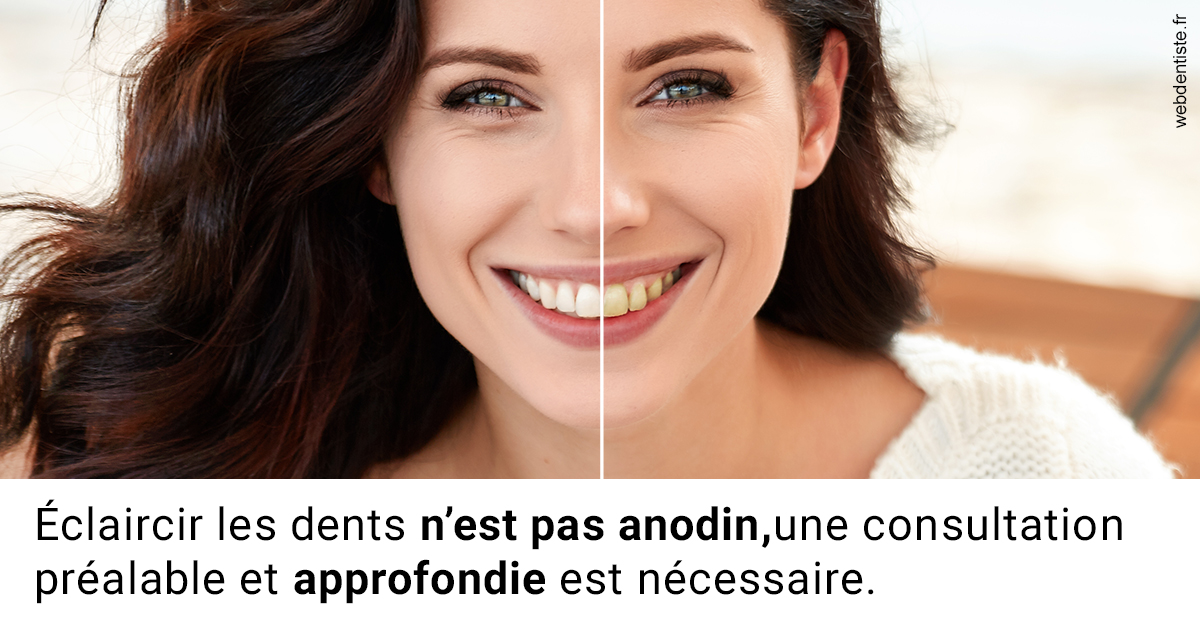 https://dr-jacques-wemaere.chirurgiens-dentistes.fr/Le blanchiment 2