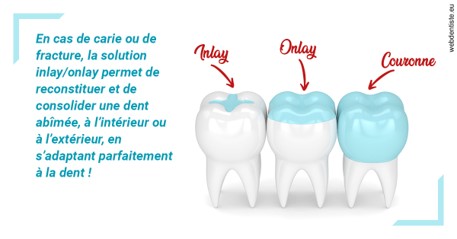 https://dr-jacques-wemaere.chirurgiens-dentistes.fr/L'INLAY ou l'ONLAY