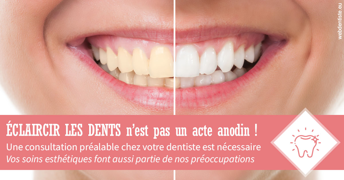 https://dr-jacques-wemaere.chirurgiens-dentistes.fr/Eclaircir les dents 1