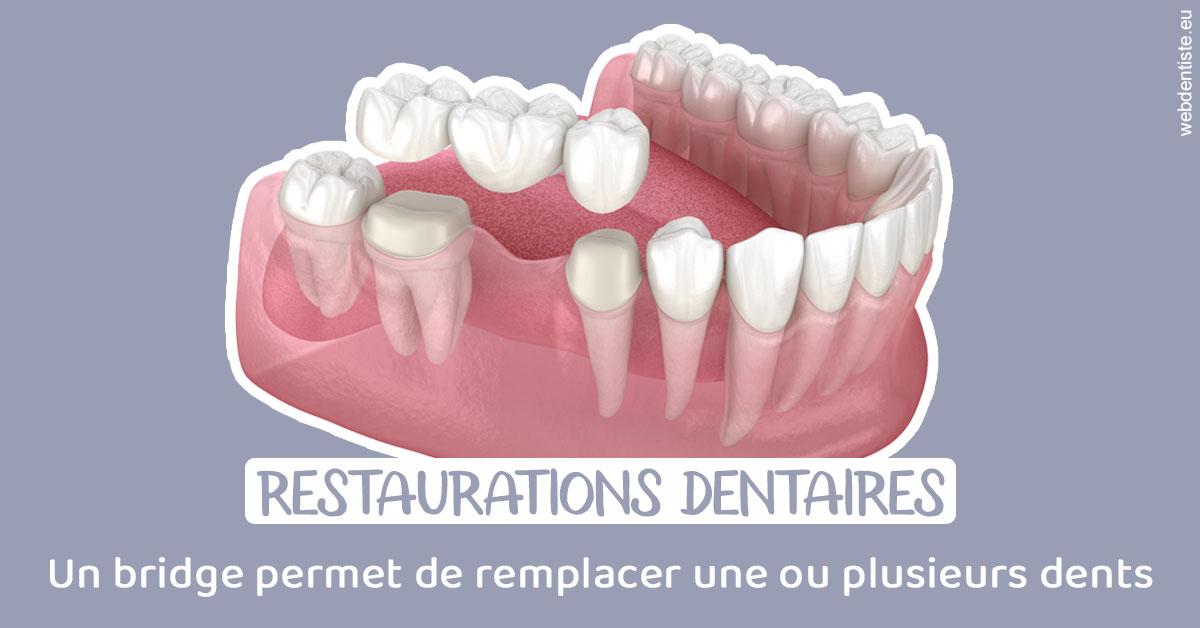 https://dr-jacques-wemaere.chirurgiens-dentistes.fr/Bridge remplacer dents 1