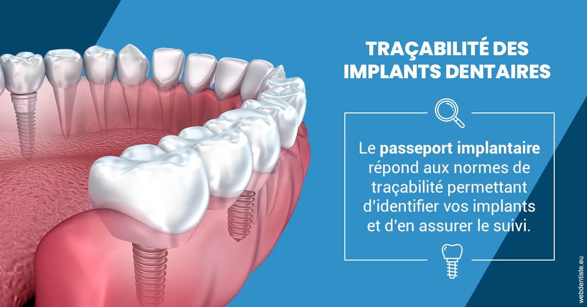https://dr-jacques-wemaere.chirurgiens-dentistes.fr/T2 2023 - Traçabilité des implants 1