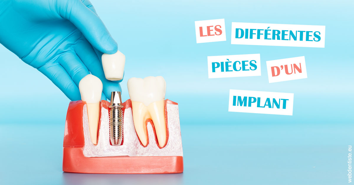 https://dr-jacques-wemaere.chirurgiens-dentistes.fr/Les différentes pièces d’un implant 2