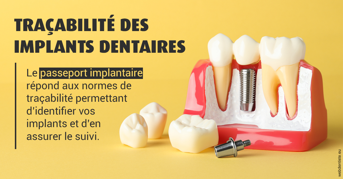 https://dr-jacques-wemaere.chirurgiens-dentistes.fr/T2 2023 - Traçabilité des implants 2