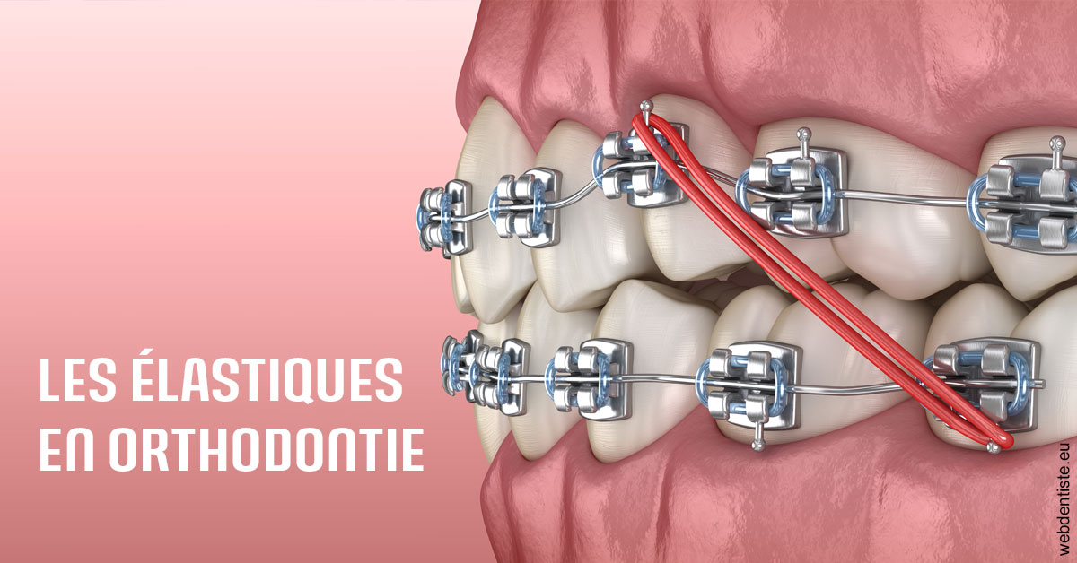 https://dr-jacques-wemaere.chirurgiens-dentistes.fr/Elastiques orthodontie 2