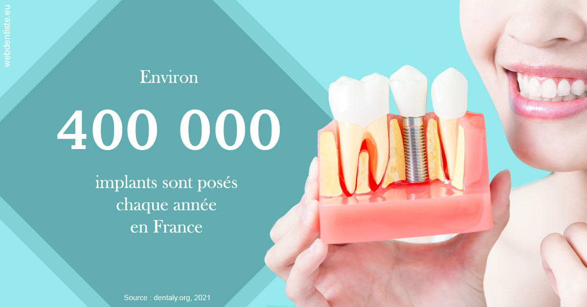 https://dr-jacques-wemaere.chirurgiens-dentistes.fr/Pose d'implants en France 2