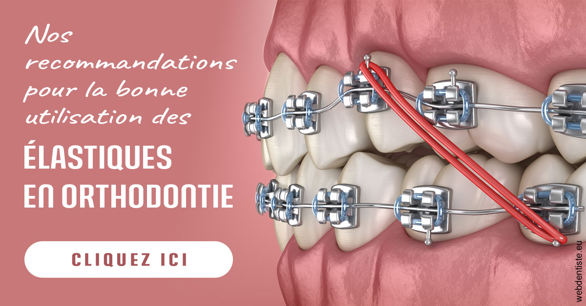 https://dr-jacques-wemaere.chirurgiens-dentistes.fr/Elastiques orthodontie 2